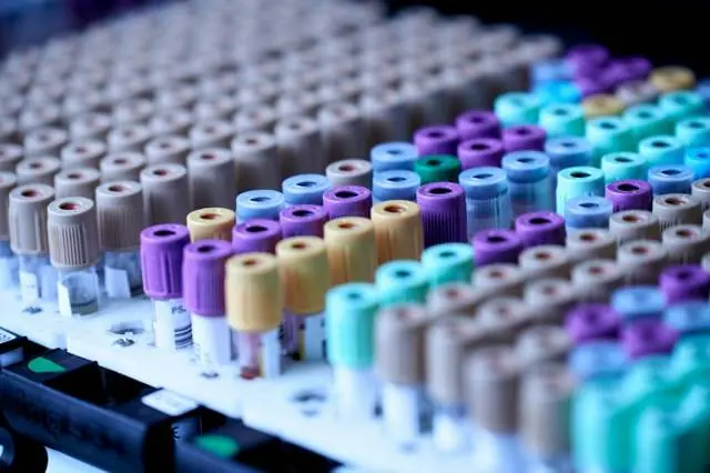 Bluttest oder Speicheltest: Hormone richtig messen